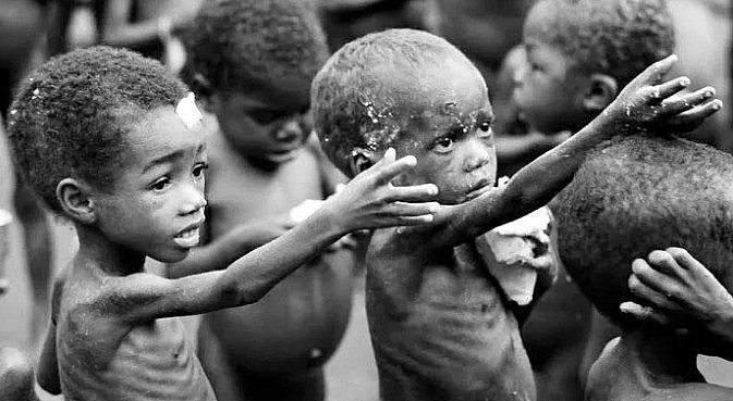Waspada Busung Lapar Jika Anak Kurus, Susah Makan, Dan Badan Yang Terus Menurun