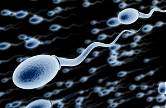 kelainan sel sperma