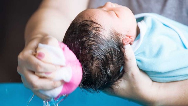 Cara Mencegah Dan Membersihkan Kepala Bayi Yang Berkerak